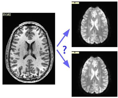 Beware (Surprisingly Common) Left-Right Flips in Your MRI Data: An Efficient and Robust Method to Check MRI Dataset Consistency Using AFNI